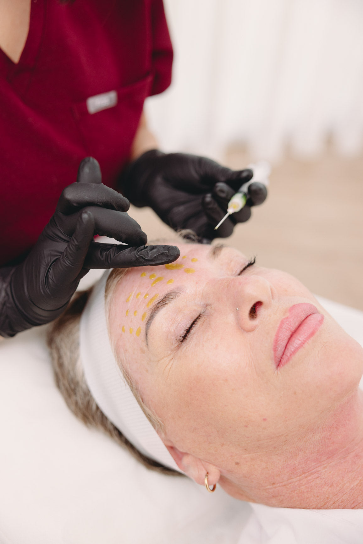 BioRePeel treatment at Your Aesthetic in Berwick for skin texture, congestion, pigmentation and rejuvenation