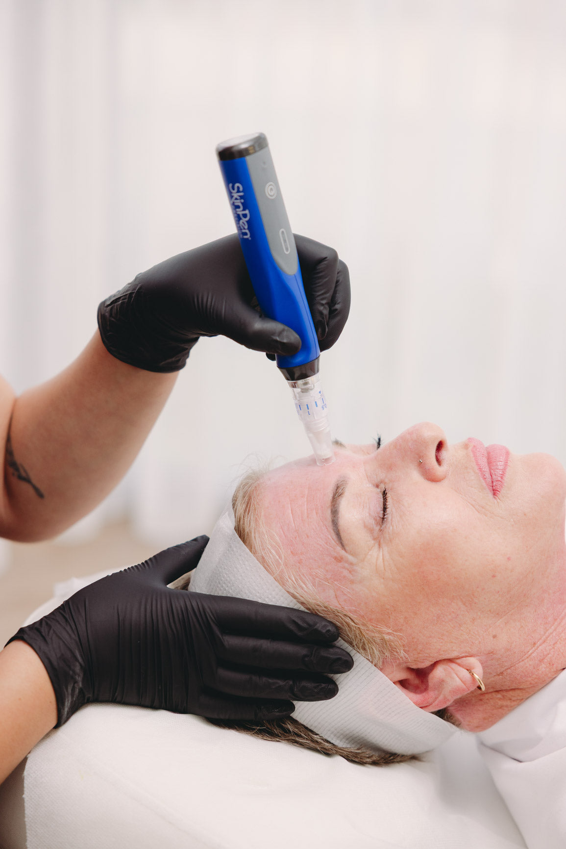 Advanced skin treatment performed at Your Aesthetic skin clinic in Berwick