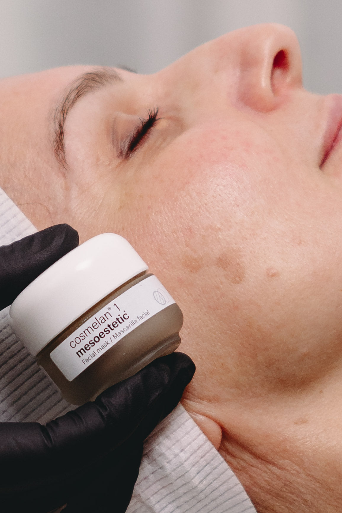 Cosmelan pigmentation treatment at Your Aesthetic in Berwick for melasma, uneven skin tone and hyperpigmentation